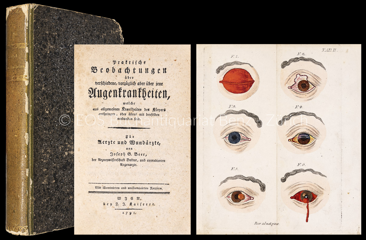 Praktische Beobachtungen über verschiedene, vorzüglich aber über jene Augenkrankheiten, welche aus allgemeinen Krankheiten des Körpers entspringen, oder öfters mit denselben verbunden sind. - EOS BUCHANTIQUARIAT BENZ Beer, Georg Joseph: -Praktische Beobachtungen über verschiedene, vorzüglich aber über jene Augenkrankheiten, welche aus allgemeinen Krankheiten des Körpers entspringen, oder öfters mit denselben verbunden sind.