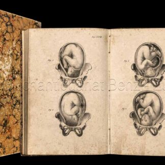 Siebold, Eduard Kaspar Jakob von: -Abbildungen aus dem Gesammtgebiete der theoretisch-praktischen Geburtshülfe, nebst beschreibender Erklärung derselben.