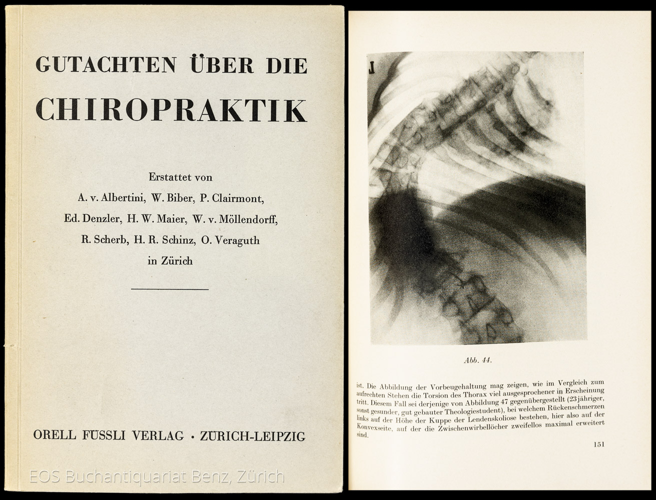 Gutachten über die Chiropraktik. - EOS BUCHANTIQUARIAT BENZ -Gutachten über die Chiropraktik.