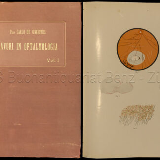 Vincentiis, Carlo de: -Lavori in Oftalmologia.