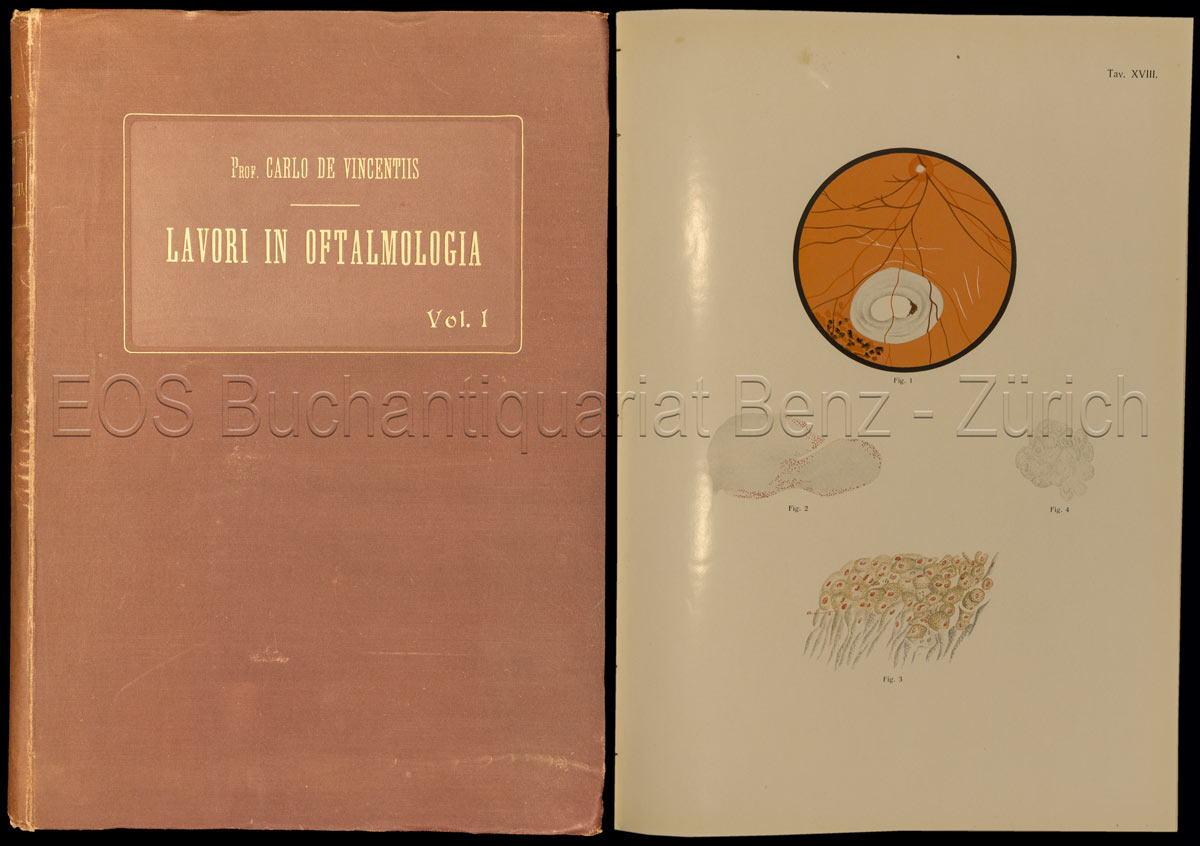 Lavori in Oftalmologia. - EOS BUCHANTIQUARIAT BENZ Vincentiis, Carlo de: -Lavori in Oftalmologia.