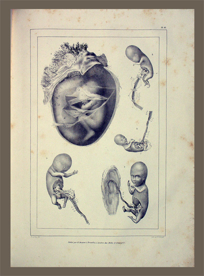 Velpeau, A(lfred-Armand)-L(ouis)-M(arie): -Embryologie ou ovologie Humaine,