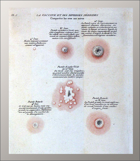 Thornton, John: Preuves de l'efficacité de la vaccine, - Image 2