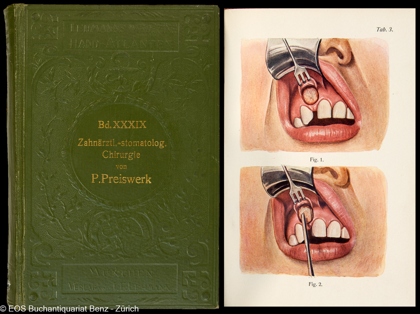 Preiswerk-Maggi, Paul: -Lehrbuch und Atlas der zahnärztlich-stomatologischen Chirurgie.