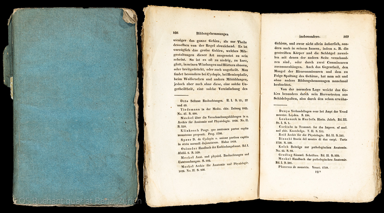 Fleischmann, Friedrich Ludwig: Bildungshemmungen der Menschen und Thiere. – Bild 2