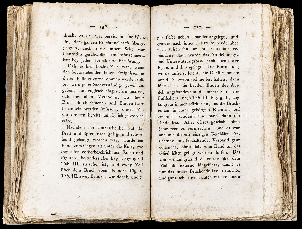 Sauter, Johann Nepomuk: Anweisung, die Beinbrüche der Gliedmassen, - Image 2