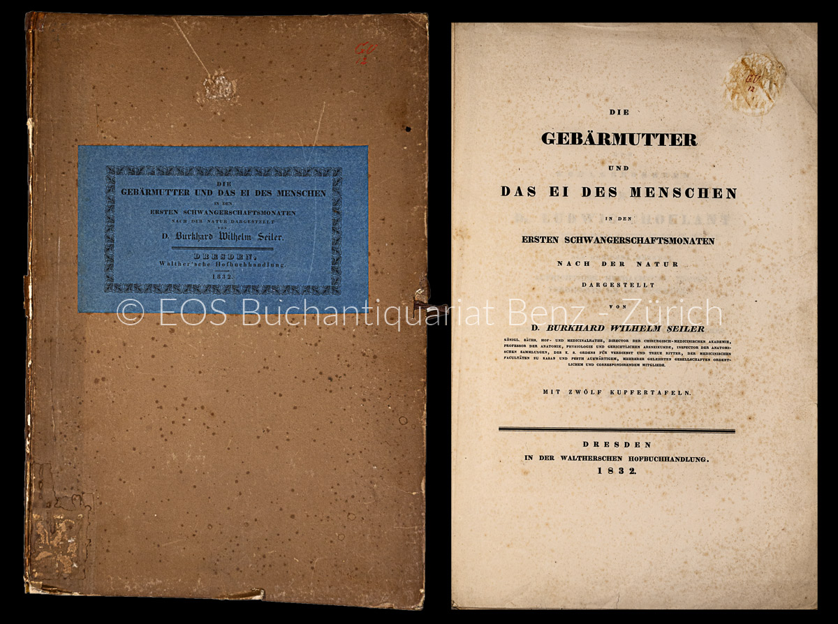 Seiler, Burkhard Wilhelm: -Die Gebärmutter