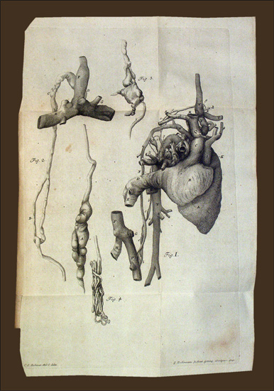 Haller, Albrecht von: -Disputationum anatomicarum selectarum.